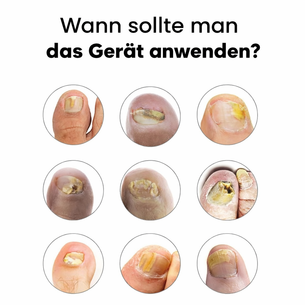 Lyvona NailLight Pro