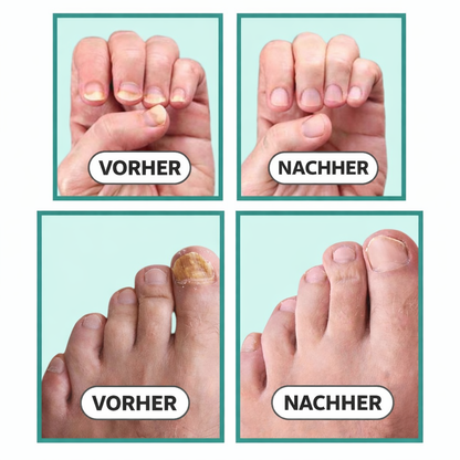 Lyvona NailLight Pro