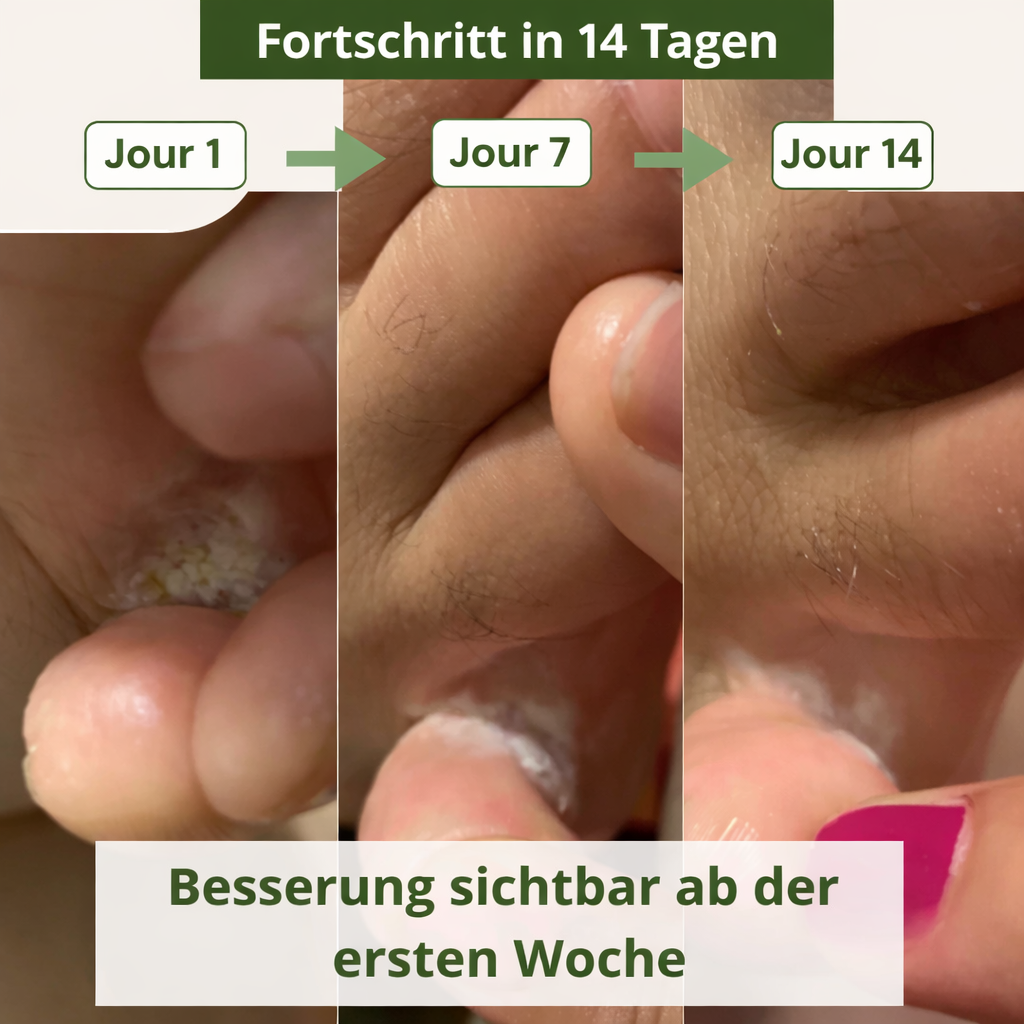 Lyvona Anti-Pilz-Seife