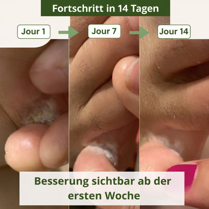 Lyvona Anti-Pilz-Seife