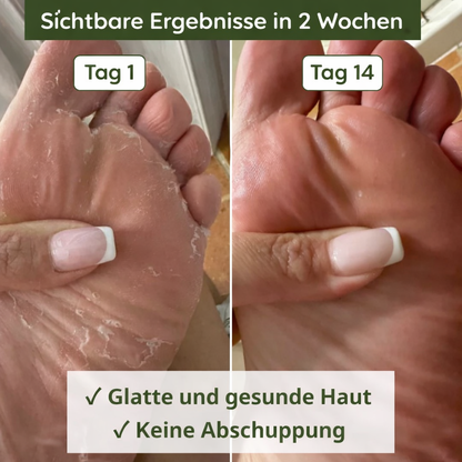 Lyvona Anti-Pilz-Seife