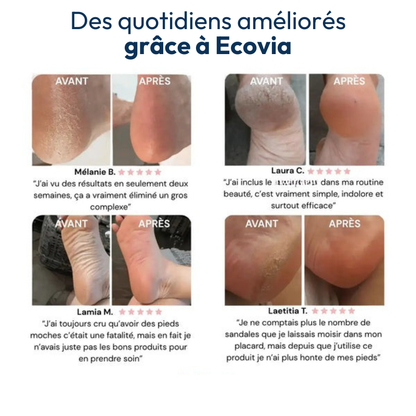 Lyvona Magische Peeling-Maske für die Füße