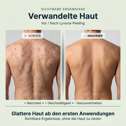 Lyvona Peeling-Duschhandtuch