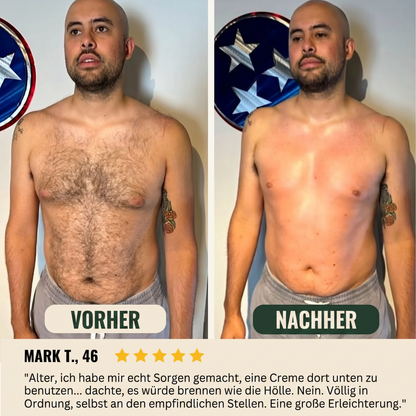 Rasieren Sie sich immer noch? Damit machen Sie es vielleicht noch schlimmer.