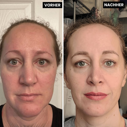 Lyvonelle™ – Die neue Alternative zu Retinol