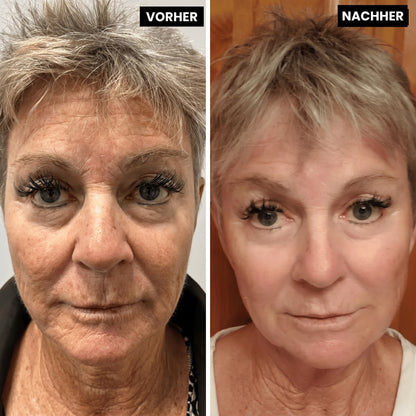 Lyvonelle™ – Die neue Alternative zu Retinol