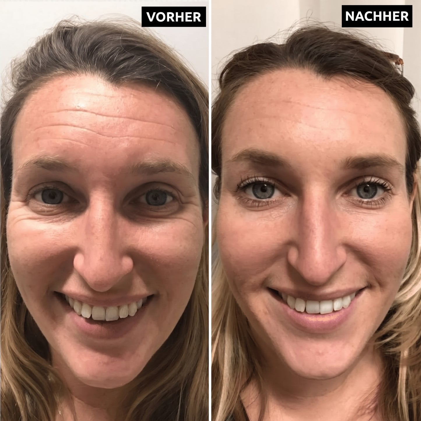 Lyvonelle™ – Die neue Alternative zu Retinol