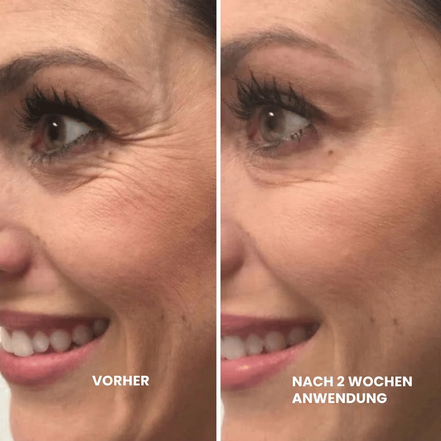 Lyvonelle™ – Die neue Alternative zu Retinol