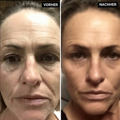 Lyvonelle™ – Die neue Alternative zu Retinol